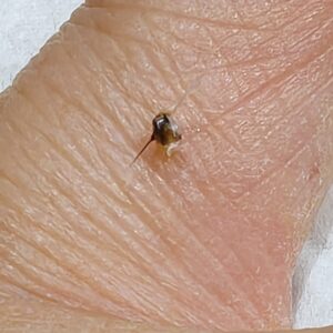 bee-stinger